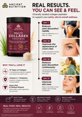 Ancient Nutrition Multi Collagen Protein Powder Unflavored 8.6oz | 24 Servings | Supports Joint Care, Skin, Hair & Nails, and Gut Health